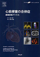 【クリックで詳細表示】心筋梗塞の合併症 画像診断アトラス