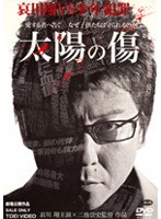 太陽の傷