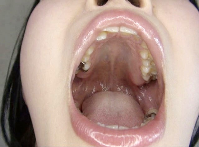 100人のおくち 第6集 サンプル画像 No.4