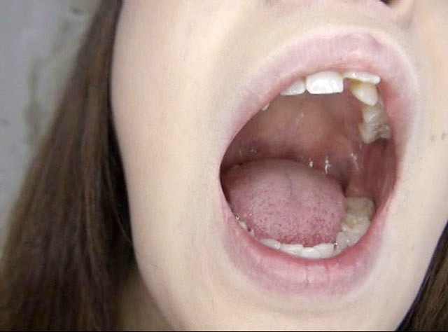 100人のおくち 第6集 サンプル画像 No.8