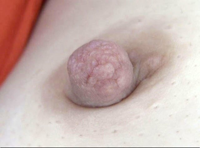 100人の乳首 第9集 サンプル画像 No.1