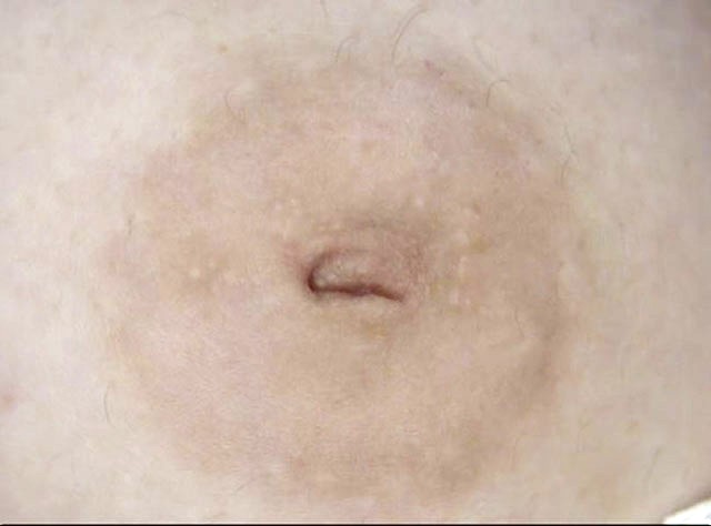 100人の乳首 第9集 サンプル画像 No.2