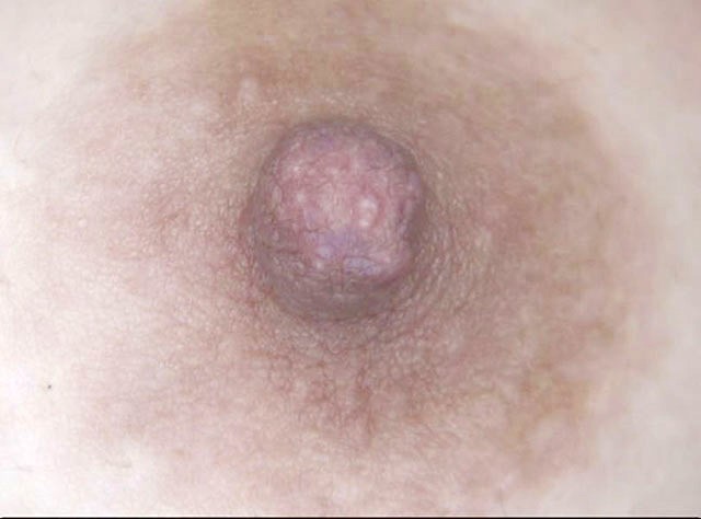 100人の乳首 第9集 サンプル画像 No.3