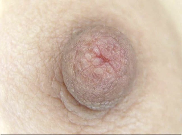 100人の乳首 第9集 サンプル画像 No.7