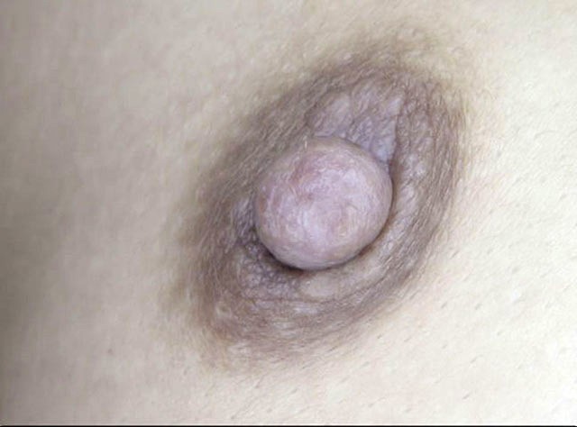 100人の乳首 第9集 サンプル画像 No.8