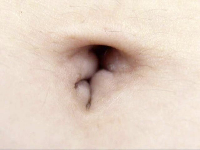 100人のへそ 第9集 サンプル画像 No.4