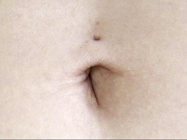 100人のへそ 第9集 サンプル画像 No.8