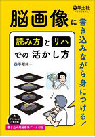 脳画像に書き込みながら身につける!読み方とリハでの活かし方