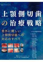上顎側切歯の治療戦略