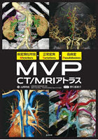 MVP CT/MRIアトラス 病変類似所見Mimickers・正常変異Variations・偽病変Pseudolesions