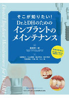 そこが知りたい！Dr.とDHのためのインプラントのメインテナンス