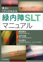 要点とリアルがわかる緑内障SLTマニュアル