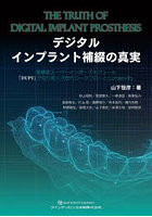 デジタルインプラント補綴の真実 高精度スーパーインポーズモジュール「DUPY」が切り拓く次世代ワークフローとLongevity