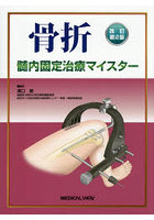 骨折髄内固定治療マイスター