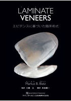 LAMINATE VENEERS エビデンスに基づいた臨床術式