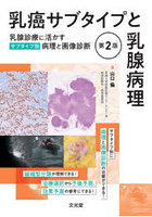乳癌サブタイプと乳腺病理