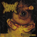 テラトーマ / TERATOMA