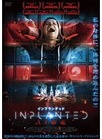 インプランテッド AI暴走