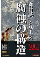 腐蝕の構造 腐蝕の構造